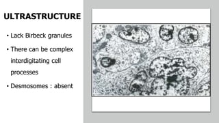 ULTRASTRUCTURE
• Lack Birbeck granules
• There can be complex
interdigitating cell
processes
• Desmosomes : absent
 