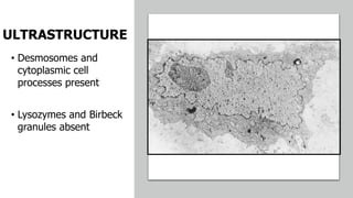 ULTRASTRUCTURE
• Desmosomes and
cytoplasmic cell
processes present
• Lysozymes and Birbeck
granules absent
 