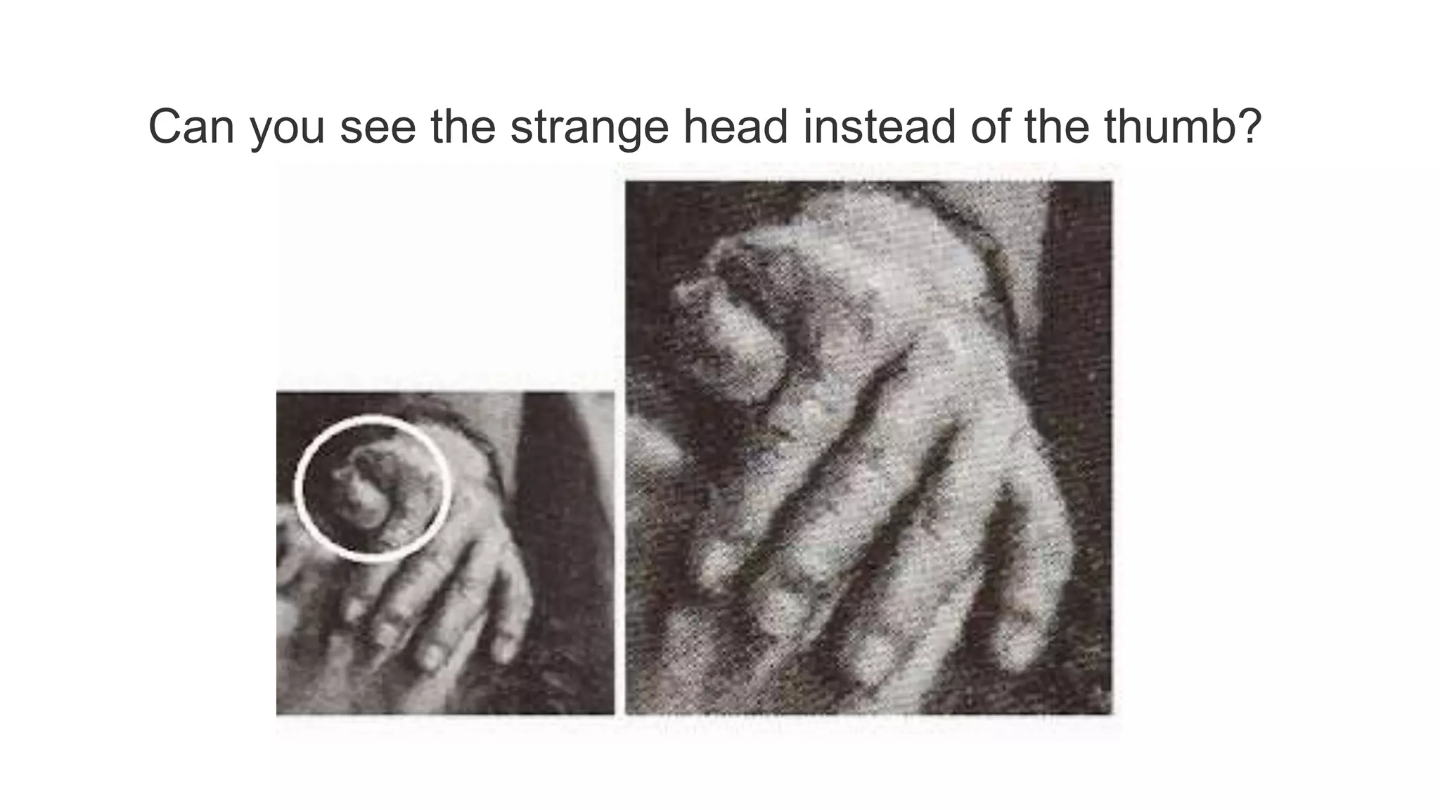 Can you see the strange head instead of the thumb?
 
