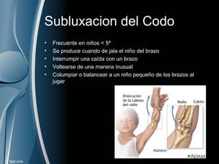 Subluxacion del Codo
• Frecuente en niños < 5ª
• Se produce cuando de jala el niño del brazo
• Interrumpir una caída con un brazo
• Voltearse de una manera inusual
• Columpiar o balancear a un niño pequeño de los brazos al
jugar
 