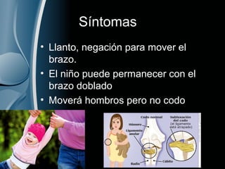 Síntomas
• Llanto, negación para mover el
brazo.
• El niño puede permanecer con el
brazo doblado
• Moverá hombros pero no codo
 