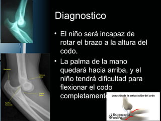 Diagnostico
• El niño será incapaz de
rotar el brazo a la altura del
codo.
• La palma de la mano
quedará hacia arriba, y el
niño tendrá dificultad para
flexionar el codo
completamente.
 