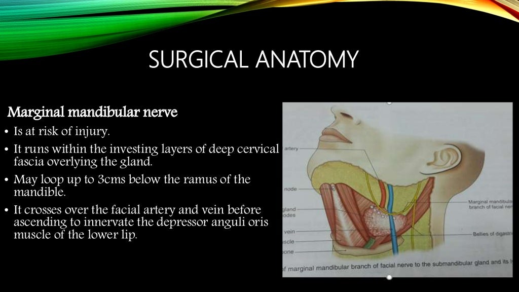 Submandibular gland excision