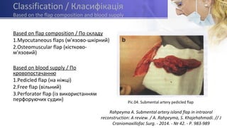 Classification / Класифікація
Based on the flap composition and blood supply
Based on flap composition / По складу
1.Myocutaneous flaps (м'язово-шкірний)
2.Osteomuscular flap (кістково-
м'язовий)
Based on blood supply / По
кровопостачанню
1.Pedicled flap (на ніжці)
2.Free flap (вільний)
3.Perforator flap (із використанням
перфоруючих судин)
Rahpeyma A. Submental artery island flap in intraoral
reconstruction: A review. / A. Rahpeyma, S. Khajehahmadi. // J
Craniomaxillofac Surg. - 2014. - № 42. - P. 983-989
Pic.04. Submental artery pedicled flap
 