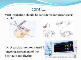 conti….
VIII) Intubation should be considered for unconscious
child
IX) A cardiac monitor is used for
ongoing assessment of the
heart rate and rhythm
 