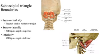 Suboccipital triangle
Boundaries
• Supero-medially
• Rectus capitis posterior major
• Supero-laterally
• Obliquus capitis superior
• Inferiorly
• Obliquus capitis inferior