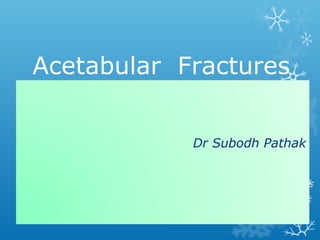 Dr Subodh Pathak
Acetabular Fractures
 