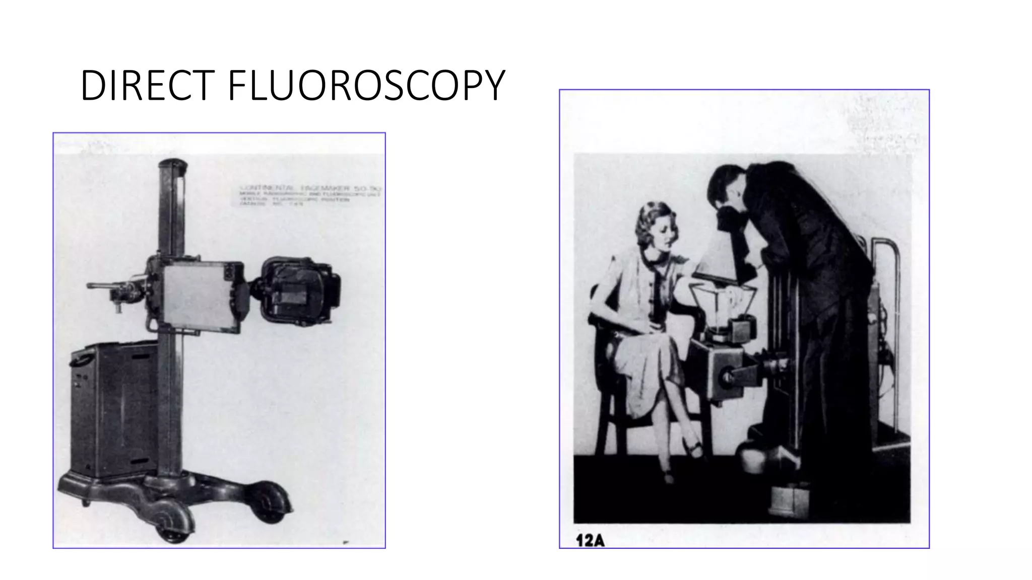 DIRECT FLUOROSCOPY
 