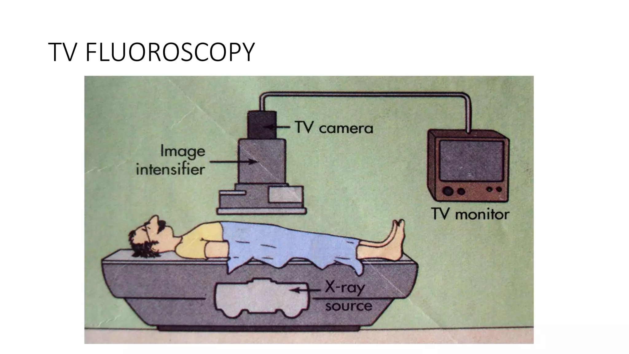 TV FLUOROSCOPY
 