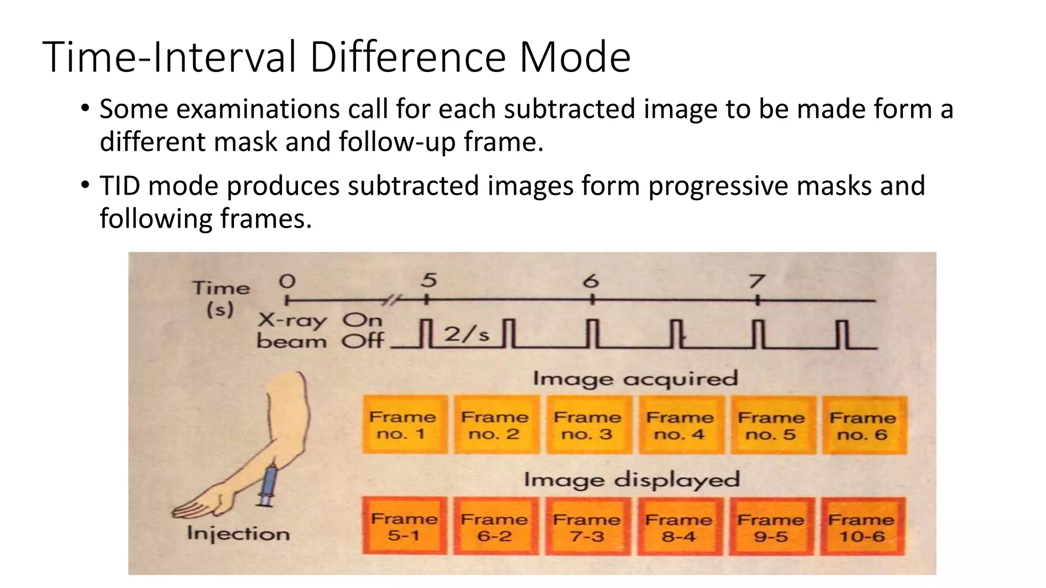 Time-Interval Difference Mode
• Some examinations call for each subtracted image to be made form a
different mask and follow-up frame.
• TID mode produces subtracted images form progressive masks and
following frames.
 