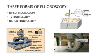 THREE FORMS OF FLUOROSCOPY
• DIRECT FLUOROSCOPY
• TV FLUOROSCOPY
• DIGITAL FLUOROSCOPY
 
