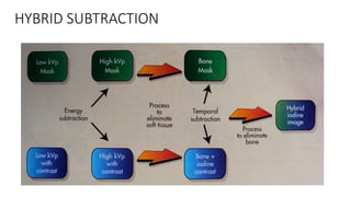 HYBRID SUBTRACTION
 