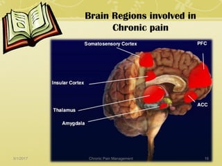 Brain Regions involved in
Chronic pain
5/1/2017 16Chronic Pain Management
 