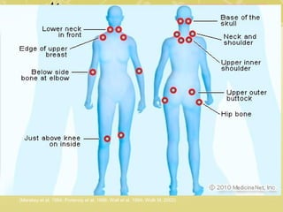 Diagnosis
Based on the 1990 ACR
classification guidelines:
• 1 historical feature + 1 physical finding
• Historical feature = widespread (axial) pain of 3 months
or more
• Physical finding = pain in at least 3 of the 4 body
segments + a finding of at least 11 tender points on
digital palpation of 18 designated tender points
(Merskey et al, 1994; Portenoy et al, 1996; Wall et al, 1994; Wolk M, 2002)
 