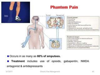 5/1/2017 Chronic Pain Management 45
Phantom Pain
Occurs in as many as 80% of amputees.
Treatment includes use of opioids, gabapentin, NMDA
antagonist & antidepressants
 