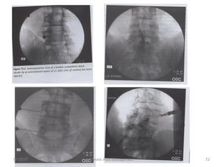 5/1/2017 72Chronic Pain Management
 