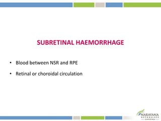 Subretinal hemorrhage | PPTX