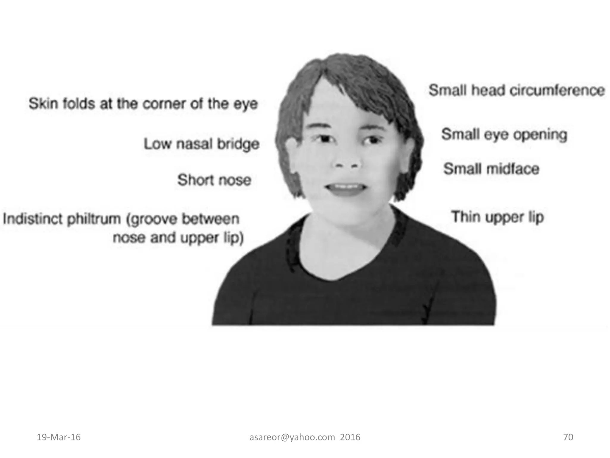 19-Mar-16 asareor@yahoo.com 2016 70
 