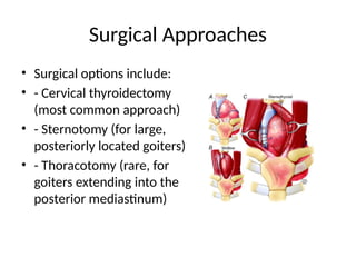Goiter Approach Substernal_Goiter surgery _Presentation.pptx