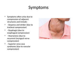 Substernal_Goiter surgery _Presentation.pptx