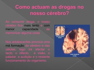 Como actuam as drogas no nosso cérebro? 	Ao consumir droga, o nosso cérebro fica mais lento e com menor capacidade de memorizar alguma coisa.	Nos adolescentes provoca uma máformação do cérebro e das células, logo irá afectar o tacto, o olfacto,  a visão, o paladar, a audição e o restante funcionamento do organismo.