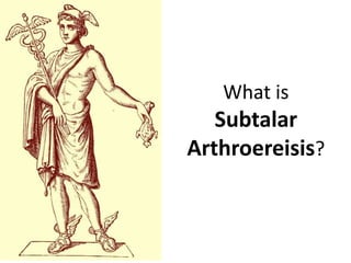 What is
   Subtalar
Arthroereisis?
 