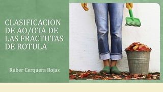 CLASIFICACION
DE AO/OTA DE
LAS FRACTUTAS
DE ROTULA
Ruber Cerquera Rojas
 