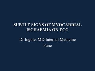 SUBTLE SIGNS OF MYOCARDIAL
ISCHAEMIA ON ECG
Dr Ingole, MD Internal Medicine
Pune
 