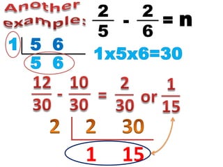 1 15
2
5
2
6
- = n
5 6
 