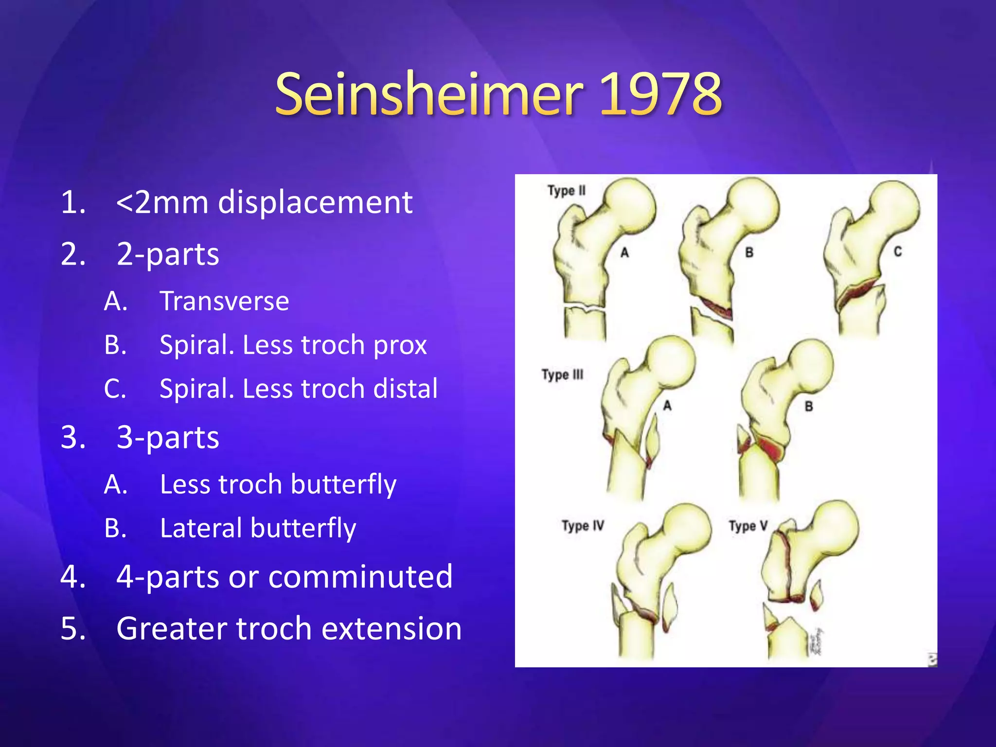 1. <2mm displacement
2. 2-parts
  A.   Transverse
  B.   Spiral. Less troch prox
  C.   Spiral. Less troch distal
3. 3-parts
  A.   Less troch butterfly
  B.   Lateral butterfly
4. 4-parts or comminuted
5. Greater troch extension
 