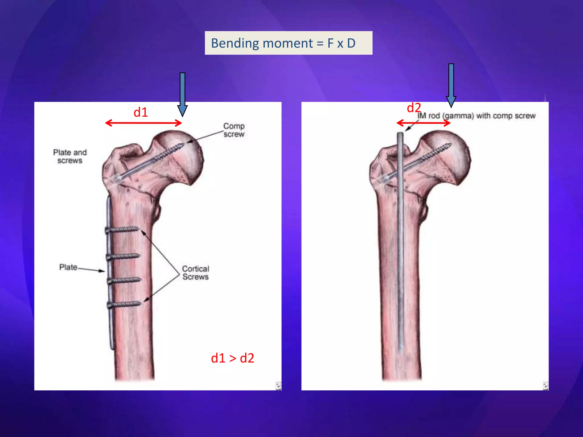 Bending moment = F x D



d1                            d2




     d1 > d2
 