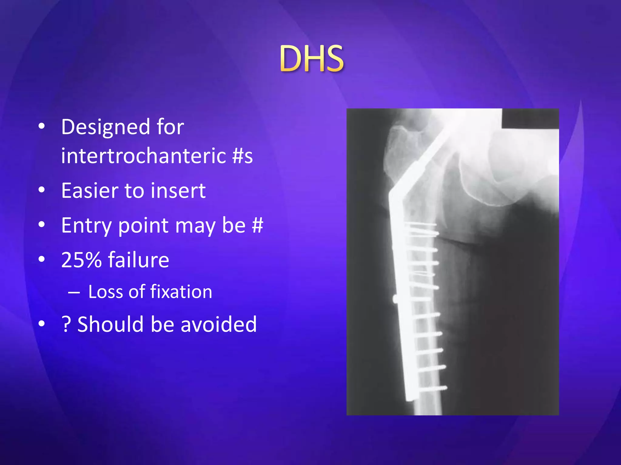 • Designed for
  intertrochanteric #s
• Easier to insert
• Entry point may be #
• 25% failure
   – Loss of fixation
• ? Should be avoided
 