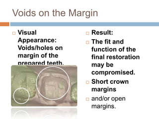 Voids on the Margin
   Visual                  Result:
    Appearance:             The fit and
    Voids/holes on           function of the
    margin of the            final restoration
    prepared teeth.          may be
    Incomplete margin.       compromised.
                            Short crown
                             margins
                            and/or open
                             margins.
 