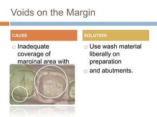 Voids on the Margin

CAUSE                      SOLUTION

   Inadequate                Use wash material
    coverage of                liberally on
    marginal area with         preparation
    light body                and abutments.
    impression material.
 
