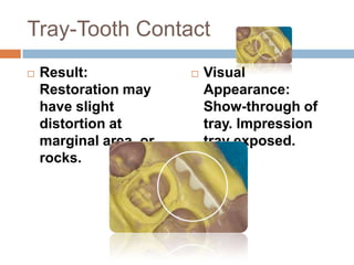 Tray-Tooth Contact
   Result:                Visual
    Restoration may         Appearance:
    have slight             Show-through of
    distortion at           tray. Impression
    marginal area, or       tray exposed.
    rocks.
 