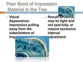 Poor Bond of Impression
Material to the Tray
   Visual                  Result: Crown(s)
    Appearance:              may be tight and
    Impression pulling       not seat fully, or
    away from the            require excessive
    sides/bottom of          internal
    tray.                    adjustment.
 