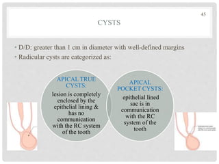 CYSTS
• D/D: greater than 1 cm in diameter with well-defined margins
• Radicular cysts are categorized as:
45
APICAL TRUE
CYSTS:
lesion is completely
enclosed by the
epithelial lining &
has no
communication
with the RC system
of the tooth
APICAL
POCKET CYSTS:
epithelial lined
sac is in
communication
with the RC
system of the
tooth
 