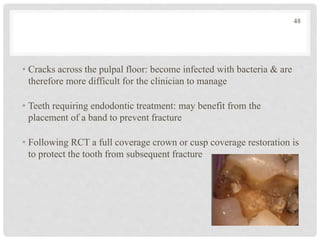 • Cracks across the pulpal floor: become infected with bacteria & are
therefore more difficult for the clinician to manage
• Teeth requiring endodontic treatment: may benefit from the
placement of a band to prevent fracture
• Following RCT a full coverage crown or cusp coverage restoration is
to protect the tooth from subsequent fracture
48
 