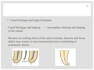 2. Canal blockage and ledge formation
• Canal blockage and ledging Incomplete cleaning and shaping
of the canals.
• Because of working short of the canal terminus, bacteria and tissue
debris may remain in non-instrumented area contributing to
endodontic failure.
53
 
