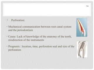 3. Perforation:
• Mechanical communication between root canal system
and the periodontium
• Cause: Lack of knowledge of the anatomy of the tooth,
misdirection of the instruments
• Prognosis : location, time, perforation seal and size of the
perforation
54
 