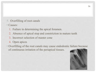 5. Overfilling of root canals
• Causes:
1. Failure in determining the apical foramen.
2. Absence of apical stop and constriction in mature teeth
3. Incorrect selection of master cone
4. Open apices
• Overfilling of the root canals may cause endodontic failure because
of continuous irritation of the periapical tissues.
56
 