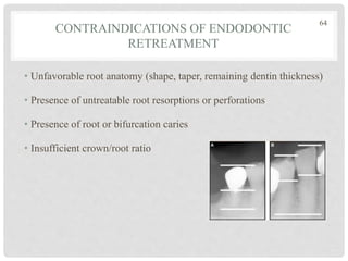 CONTRAINDICATIONS OF ENDODONTIC
RETREATMENT
• Unfavorable root anatomy (shape, taper, remaining dentin thickness)
• Presence of untreatable root resorptions or perforations
• Presence of root or bifurcation caries
• Insufficient crown/root ratio
64
 