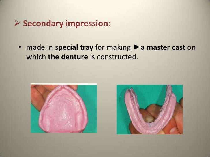 Success of complete denture
