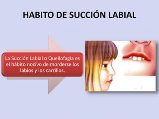 HABITO DE SUCCIÓN LABIAL
La Succión Labial o Queilofagia es
el hábito nocivo de morderse los
labios y los carrillos.
 