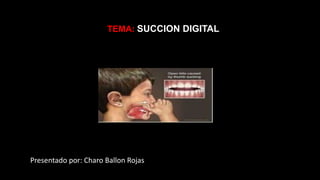 TEMA: SUCCION DIGITAL
Presentado por: Charo Ballon Rojas
 