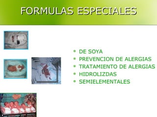FORMULAS ESPECIALES



           DE SOYA
           PREVENCION DE ALERGIAS
           TRATAMIENTO DE ALERGIAS
           HIDROLIZDAS
           SEMIELEMENTALES
 