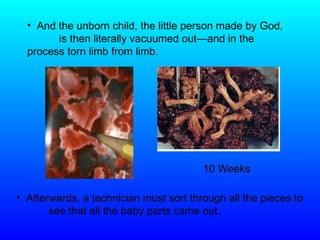 And the unborn child, the little person made by God,  is then literally vacuumed out — and in the  process torn limb from limb.  10 Weeks Afterwards, a technician must sort through all the pieces to  see that all the baby parts came out. 