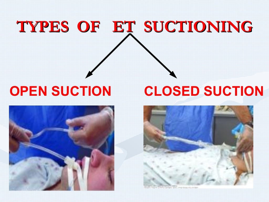 Endo tracheal Suctioning