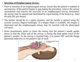 • Insertion of Oropharyngeal Airway-
• Prior to insertion of an oropharyngeal airway, ensure that the patient is sedated or
unconscious. If the patient begins to gag during the procedure, remove the airway
immediately and reassess the necessity of an oropharyngeal airway. Sometimes
the airway may be opened and maintained by repositioning of the head (e.g., head
tilt-chin lift, jaw thrust).
• The patient should be in a supine position, and the mouth is opened using the
scissors (crosses fingers) technique. If a tongue blade is available, the tongue is
depressed and the oropharyngeal airway may be inserted with the pharyngeal
curvature.
• Some practitioners prefer to insert the airway into the patient’s mouth upside
down so that the distal end of the airway is facing the hard palate (roof of the
patient’s mouth). As the airway is inserted fully, it is turned 180° until the flange
(proximal end) rests on the patient’s lips or teeth.
11
 