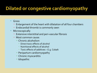  Gross
  ▪ Enlargement of the heart with dilatation of all four chambers
  ▪ Endocardial thrombi is commonly seen
 Microscopically
  ▪ Extensive interstitial and peri-vascular fibrosis
  ▪ Most common cause:
    ▪ Chronic alcoholism
        Direct toxic effects of alcohol
        Nutritional effects of alcohol
        Toxic effects of additives – E.g. Cobalt
     ▪ Peripartum cardiomyopathy
     ▪ Chronic myocarditis
     ▪ Idiopathic
 